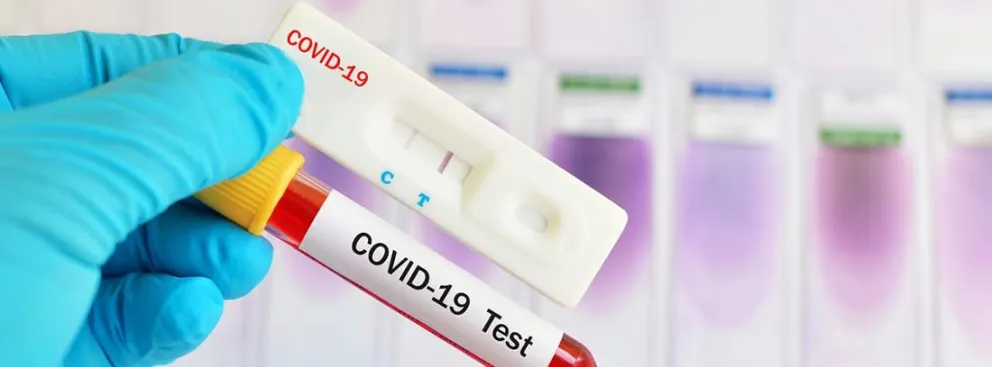 Dudas Covid-19: qué diferencias hay entre un autotest y el PCR 