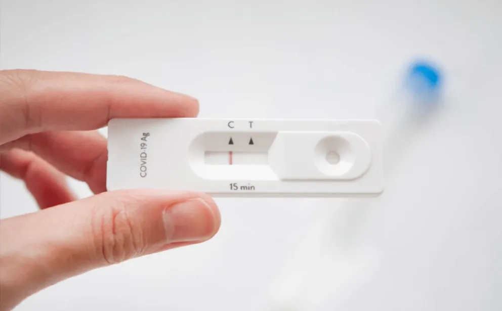 Autotest de Covid-19: se venden “lento” y la mayoría informa el resultado