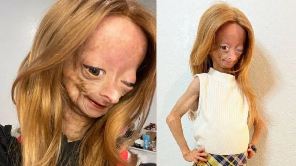 Murió Adalia Williams quien inspiró a “El curioso caso de Benjamin Button”