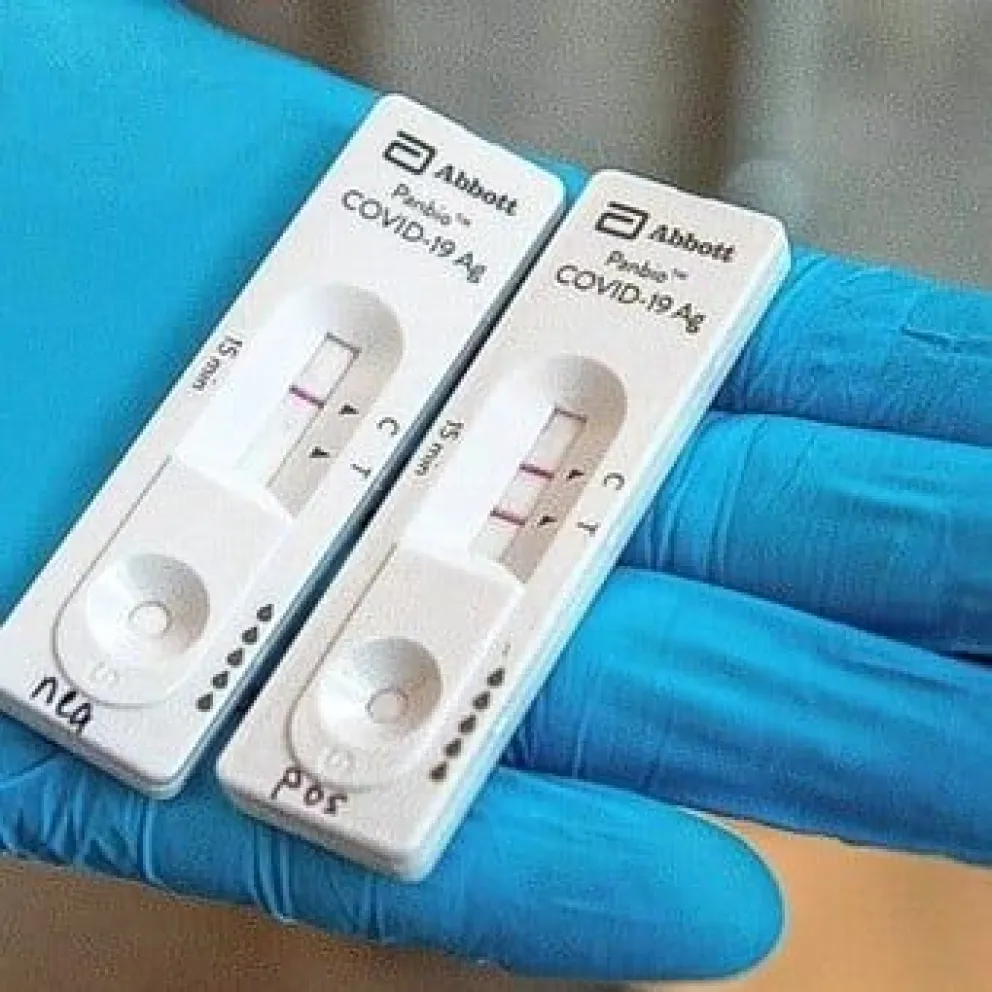 Autotest de COVID: ¿Cuánto saldrán y cuándo llegarán?