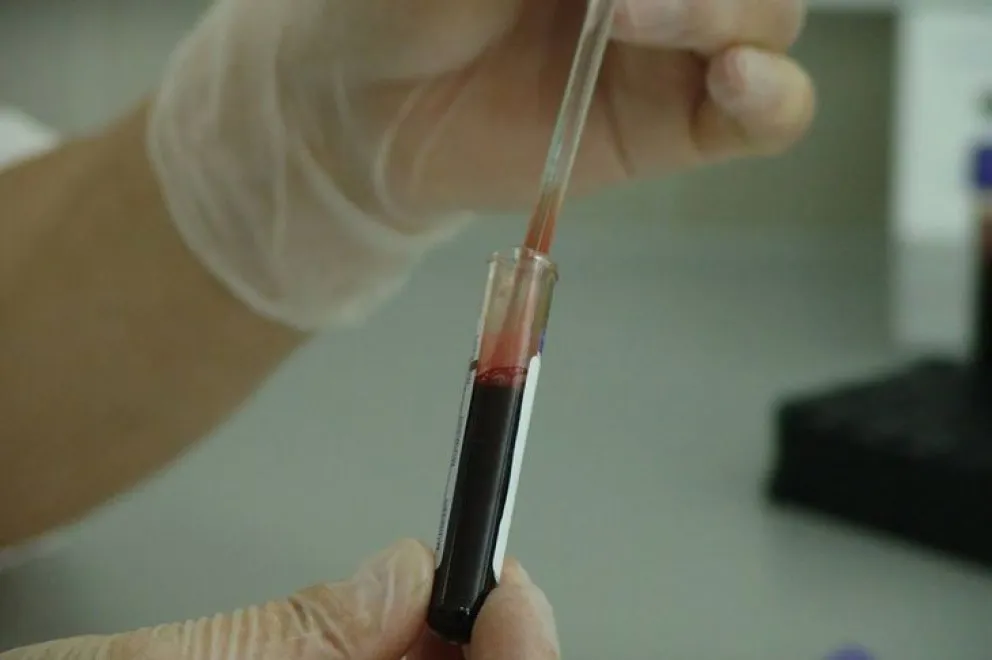 Científicos descubrieron una variante del VIH mucho más virulenta y contagiosa