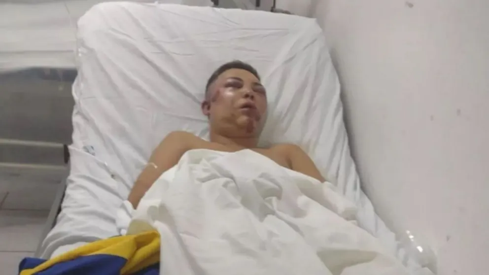 A la salida de un boliche: golpearon brutalmente a un joven por una gorra 