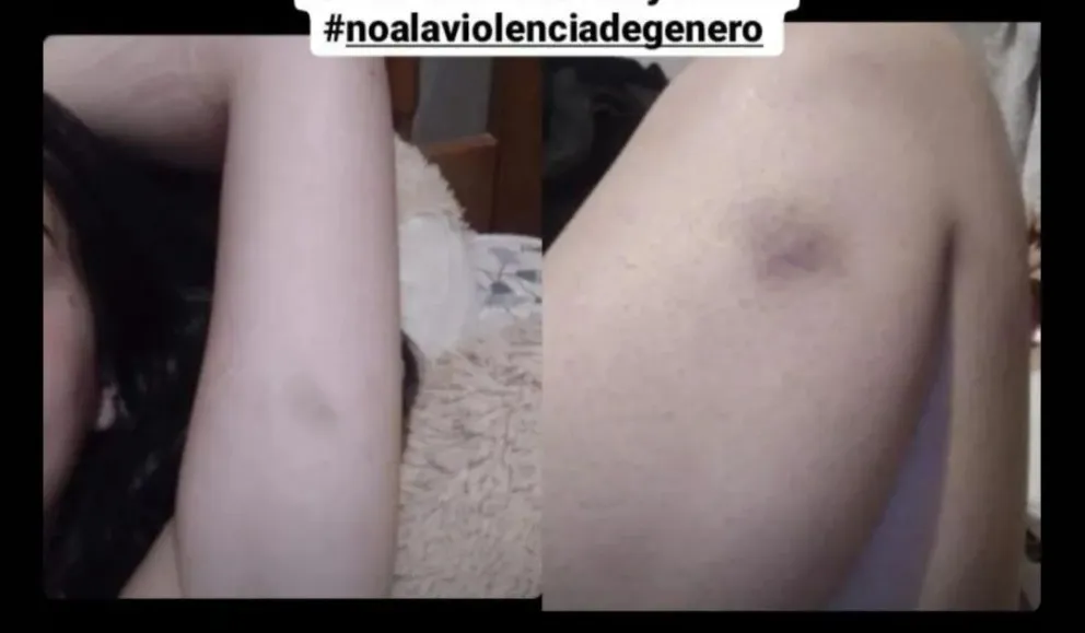 Viedma: denuncian a un violento machirulo apañado por su mamá