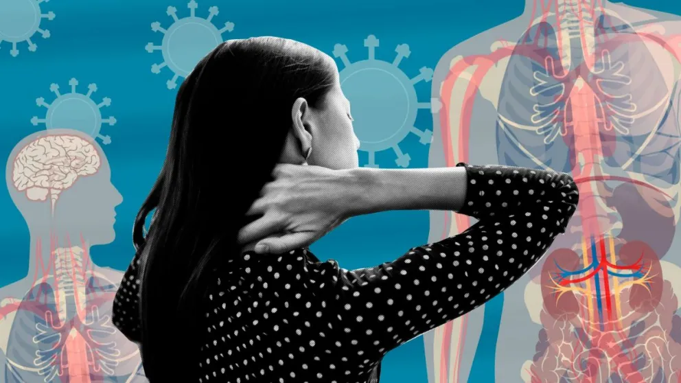 Covid prolongado: síntomas y todo lo que se conoce hasta hoy