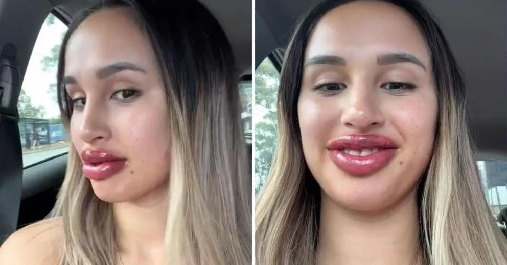 Se tatuó los labios por un canje pero no resultó lo que esperaba